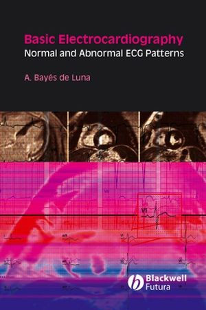 Basic Electrocardiography Normal And Abnormal Ecg Patterns A Bayes De Lunaauth