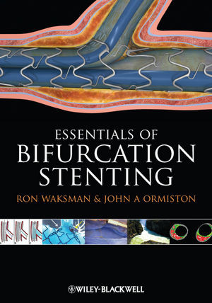 Bifurcation Stenting Ron Waksman John A Ormiston