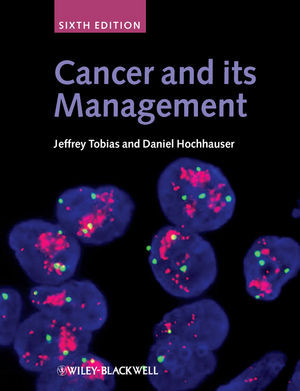 Cancer And Its Management 6th Edition Jeffrey Tobias Daniel Hochhauserauth