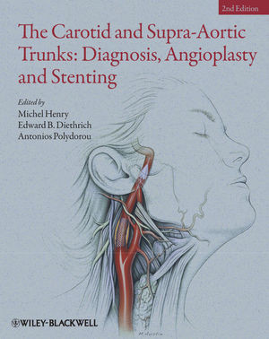 The Carotid And Supraaortic Trunks Diagnosis Angioplasty And Stenting 2nd Edition Michel Henry