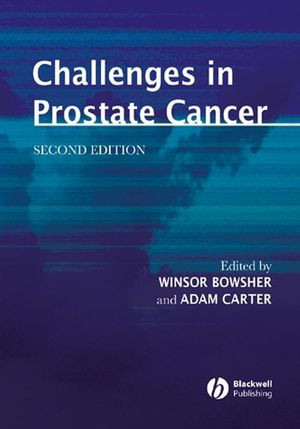 Challenges In Prostate Cancer Second Edition Winsor Bowsher
