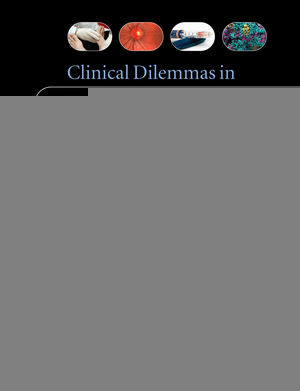 Clinical Dilemmas In Diabetes Adrian Vella