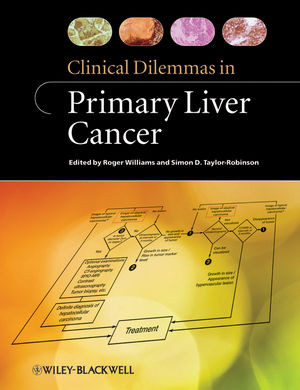 Clinical Dilemmas In Primary Liver Cancer Roger Williams Simon D Taylorrobinson