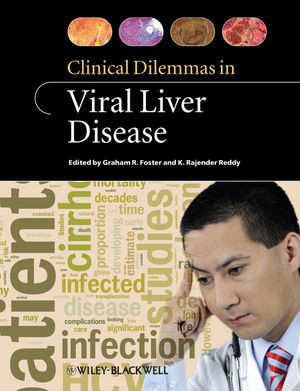 Clinical Dilemmas In Viral Liver Disease Graham R Foster K Rajender Reddy
