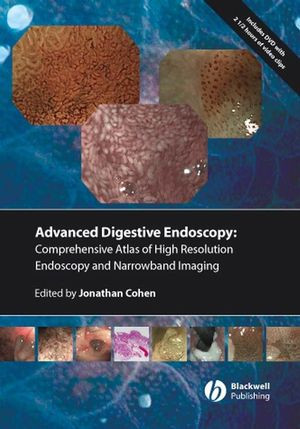 Comprehensive Atlas Of High Resolution Endoscopy And Narrow Band Imaging Jonathan Cohen