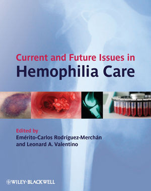 Current And Future Issues In Hemophilia Care Emeritocarlos