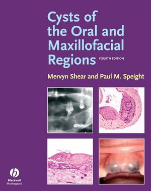 Cysts Of The Oral And Maxillofacial Regions Fourth Edition Mervyn Shear