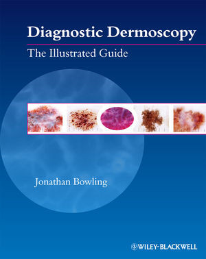 Diagnostic Dermoscopy The Illustrated Guide Jonathan Bowlingauth