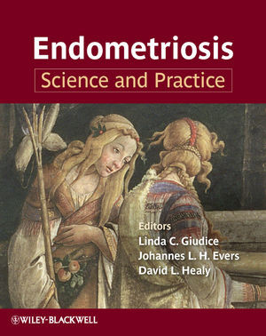 Endometriosis Science And Practice Linda C Giudice