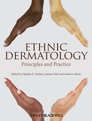 Ethnic Dermatology Principles And Practice Ophelia E Dadzie