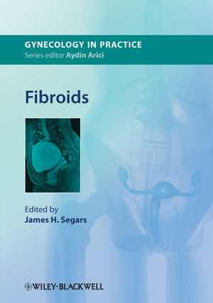 Fibroids James H Segars