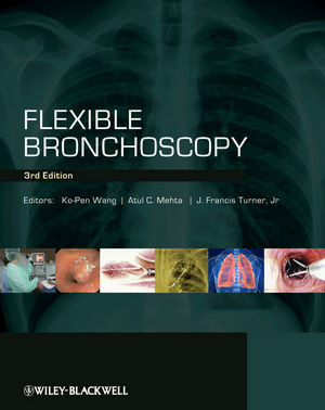 Flexible Bronchoscopy Third Edition Kopen Wang Atul C Mehta