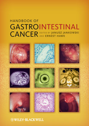 Handbook Of Gastrointestinal Cancer Janusz Jankowski Ernest Hawk