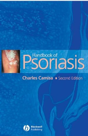 Handbook Of Psoriasis Second Edition Charles Camisa