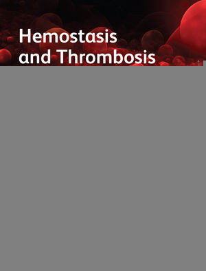 Hemostasis And Thrombosis In Obstetrics Gynecology Michael J Paidas