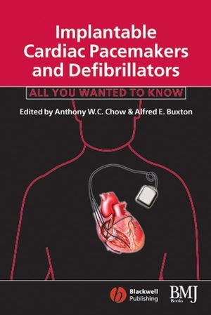 Implantable Cardiac Pacemakers And Defibrillators All You Wanted To Know Anthony W C Chow