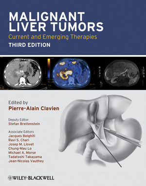Malignant Liver Tumors Current And Emerging Therapies Third Edition Pierrealain Clavien