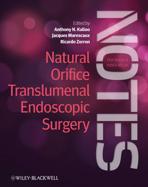 Natural Orifice Translumenal Endoscopic Surgery Notes Anthony N Kalloo