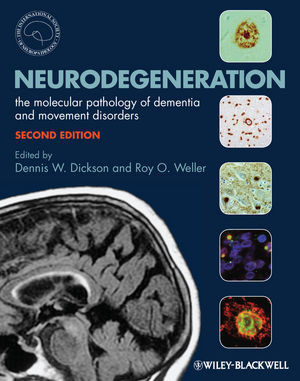 Neurodegeneration The Molecular Pathology Of Dementia And Movement Disorders Second Edition 2nd Edition Dennis Dickson