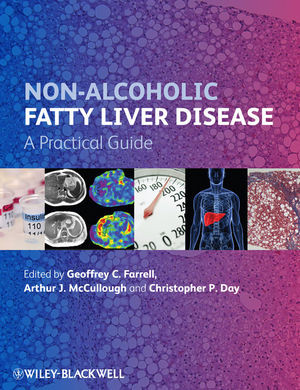 Nonalcoholic Fatty Liver Disease A Practical Guide Geoffrey C Farrell