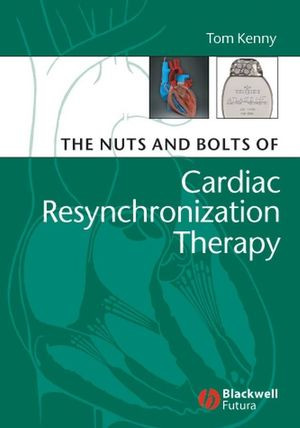 The Nuts And Bolts Of Cardiac Resynchronization Therapy Tom Kenny
