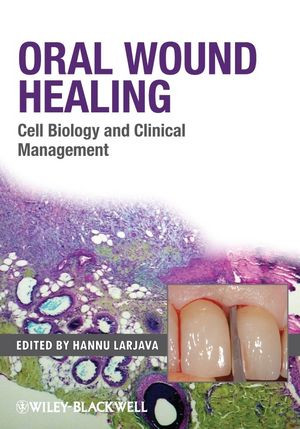 Oral Wound Healing Hannu Larjava
