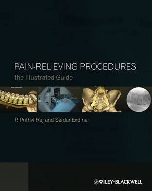 Painrelieving Procedures The Illustrated Guide P Prithvi Raj