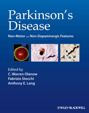 Parkinsons Disease Nonmotor And Nondopaminergic Features G Hussein Rassool