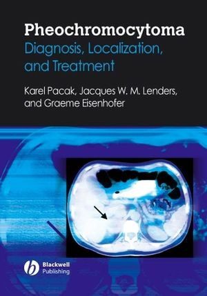 Pheochromocytoma Diagnosis Localization And Treatment Karel Pacak