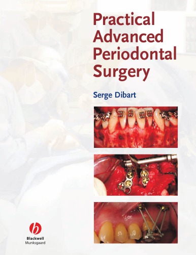 Practical Advanced Periodontal Surgery Serge Dibartauth