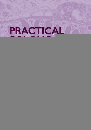 Practical Colonoscopy Jerome D Waye James Aisenberg Peter H Rubinauth