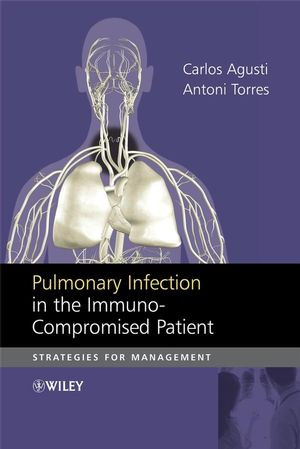Pulmonary Infection In The Immunocompromised Patient Strategies For Management Carlos Agusti
