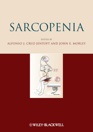 Sarcopenia Alfonso J Cruzjentoft John E Morley