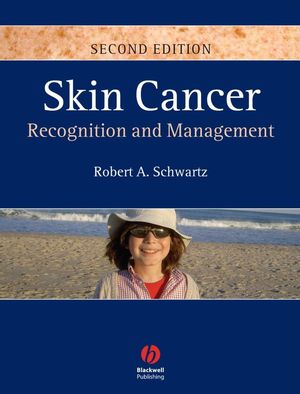 Skin Cancer Recognition And Management Second Edition Robert A Schwartzauth