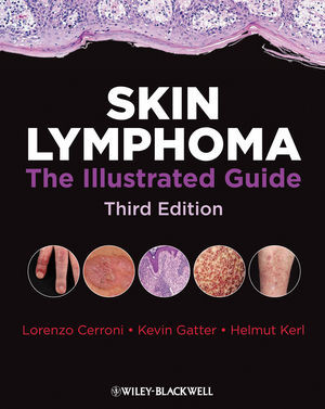 Skin Lymphoma The Illustrated Guide Third Edition Lorenzo Cerroni