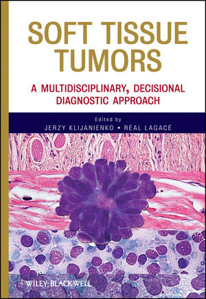Soft Tissue Tumors A Multidisciplinary Decisional Diagnostic Approach Klijanienko