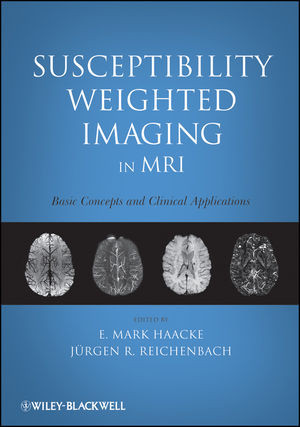 Susceptibility Weighted Imaging In Mri Basic Concepts And Clinical Applications E Mark Haacke
