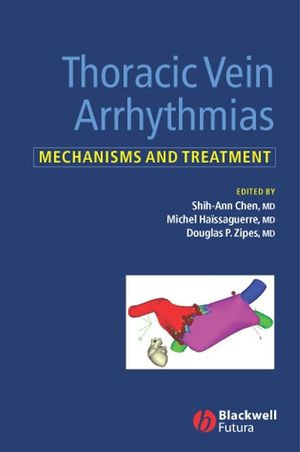 Thoracic Vein Arrhythmias Mechanisms And Treatment Shihann Chen