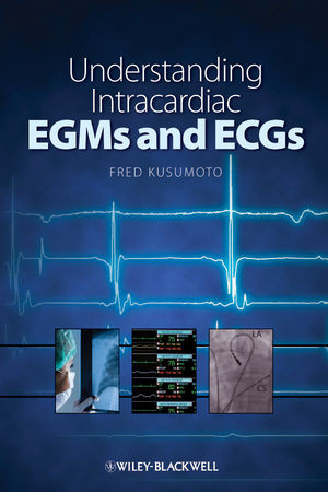 Understanding Intracardiac Egms And Ecgs Fred Kusumotoauth