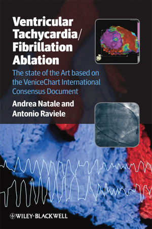 Ventricular Tachycardiafibrillation Ablation The State Of The Art Based On The Venicechart International Consensus Document Andrea Natale