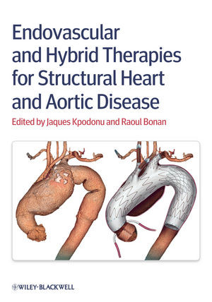 Endovascular And Hybrid Therapies For Structural Heart And Aortic Disease Jacques Kpodonu