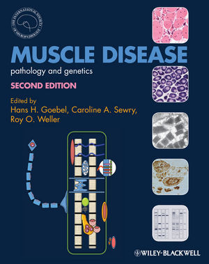 Muscle Disease Pathology And Genetics Second Edition 2nd Edition Hans H Goebel