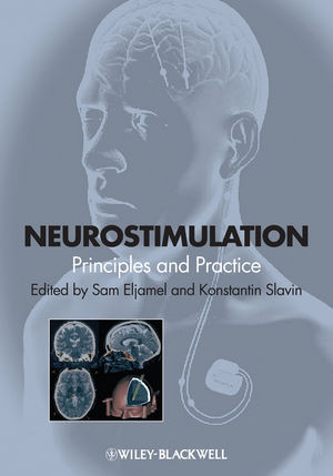 Neurostimulation Principles And Practice Sam Eljamel Konstantin V Slavineds