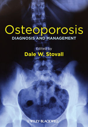 Osteoporosis Diagnosis And Management Dale W Stovalleds