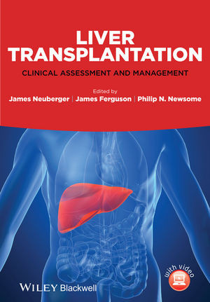 Liver Transplantation Clinical Assessment And Management James Neuberger