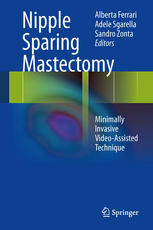 Nipple Sparing Mastectomy Minimally Invasive Videoassisted Technique 1st Edition Alberta Ferrari