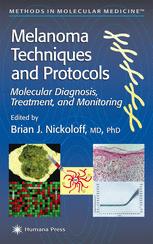 Melanoma Techniques And Protocols Molecular Diagnosis Treatment And Monitoring 1st Edition Brian J Nickoloff Auth