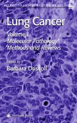 Lung Cancer Volume 1 Molecular Pathology Methods And Reviews 1st Edition Ignacio I Wistuba