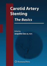 Carotid Artery Stenting The Basics 1st Edition Rohit Khurana Bmbch