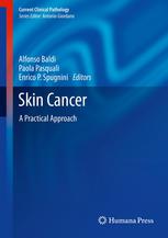 Skin Cancer A Practical Approach 1st Edition Maria De Falco